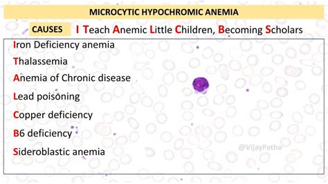 Microcytic Hypochromic Anemia: Causes and Diagnosis - Pathology Made Simple