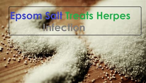 How Epsom Salt Treats Herpes? :: NATURAL HERPES CURE