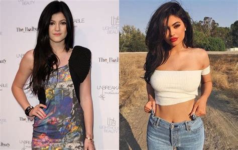 [最新] makeup kylie jenner before surgery daily mail 127361