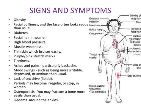 Adrenal gland disorders