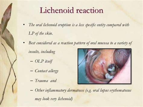 Oral precancerous lesions