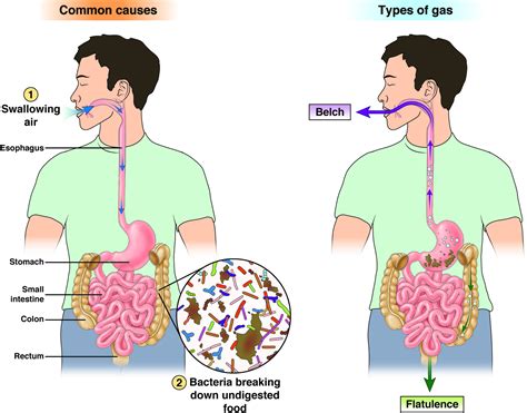 What Is Excessive Belching A Symptom Of