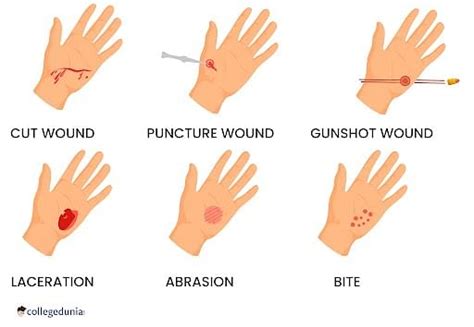 Incised Wound Vs Laceration