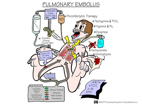 Nursing School: Medical Surgical Nursing Mnemonics