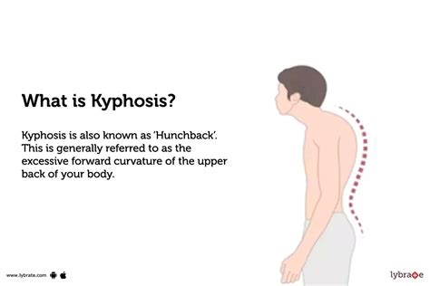 Kyphosis: Symptoms, Causes, Treatment, Cost, and Side Effects