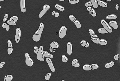 MicroChoice Denitrifying Bacteria