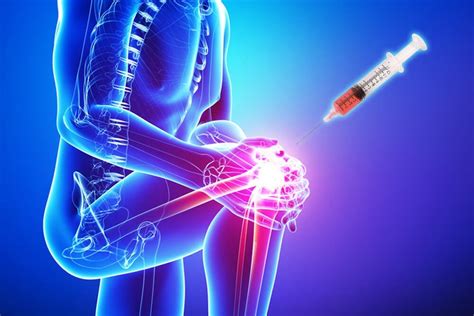 Stem Cell Therapy vs PRP Therapy for Arthritis | PRP Injection MD