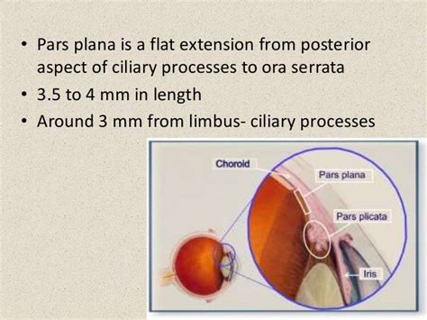 Intermediate uveitis