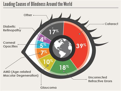 Lack of Access to Eye Care Services Leading to Avoidable Blindness