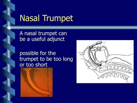 PPT - Airway Management in Transport PowerPoint Presentation, free ...