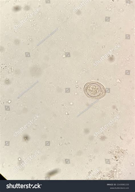 Hymenolepis Nana Egg Under Light Microscopex40 Stock Photo 2143081155 ...