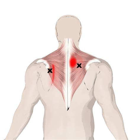 The Trapezius Muscle, Its Attachments And Actions - Yoganatomy