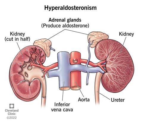 Aldosterone Potassium