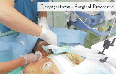 Laryngectomy - Procedure, Risks and Post Laryngectomy Therapy