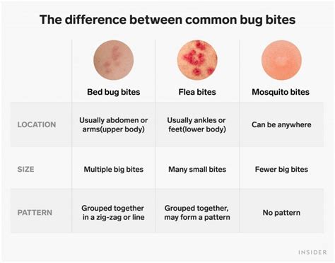 How to identify and treat bed bug bites