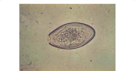 Morphology of oxyuris equi egg. | Download Scientific Diagram