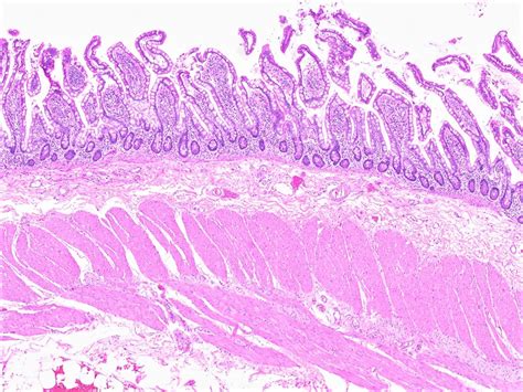 Small Intestine Histology Diagram