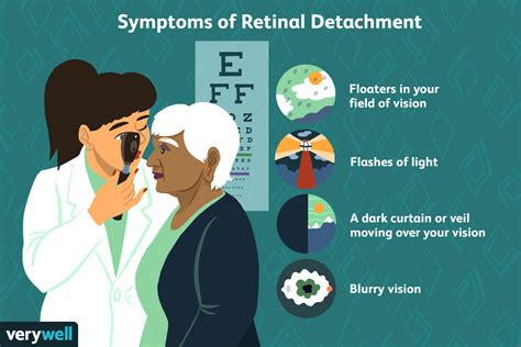 Detached Retina: Overview and More