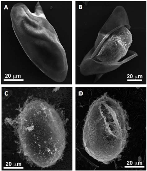 Morphology of Schistosoma mansoni and Schistosoma japonicum eggs. Panel ...