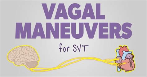 Vagal Maneuvers: How to Stop your Patient’s SVT in 2021 | Sinus massage ...