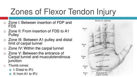 Flexor tendon injuries