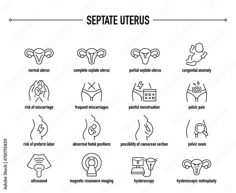 Septate Uterus symptoms, diagnostic and treatment vector icons. Line ...