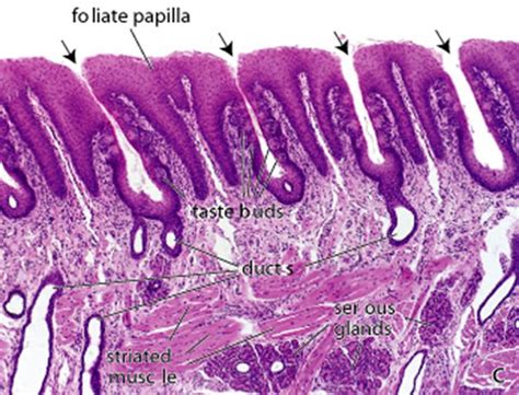 taste buds slide labeled papillae taste pores - Google Search ...