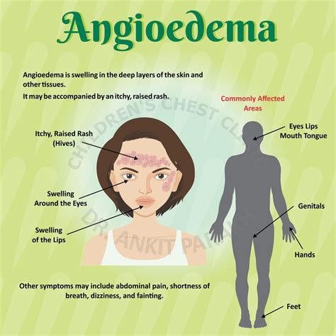 Angioedema in Children - Dr. Ankit Parakh