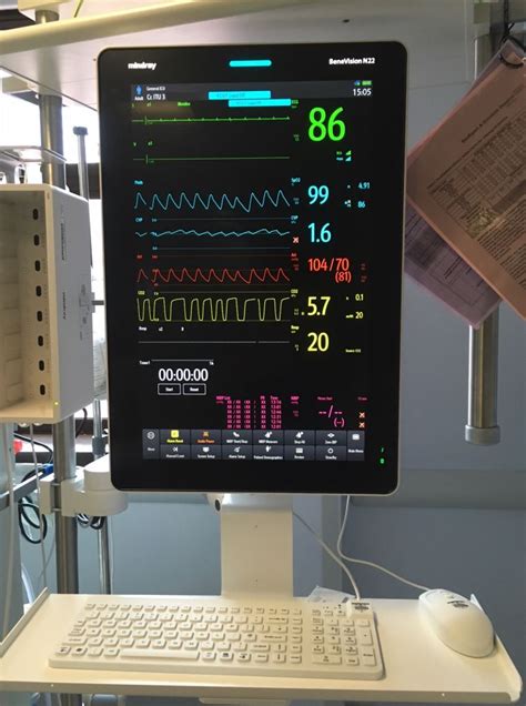 Cardiac Monitor – ICU Knowledge