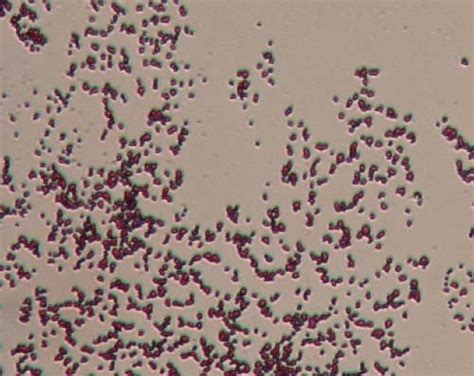 Morphology of lactic acid bacteria samples (1000x magnification ...