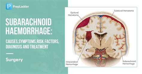 Subarachnoid Haemorrhage: Causes, Symptoms, Risk Factors, Diagnosis and ...