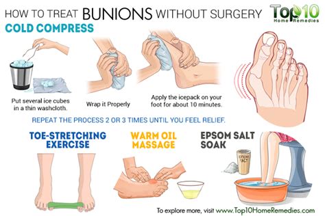 how to treat bunions without surgery Bunion Exercises, Foot Exercises ...