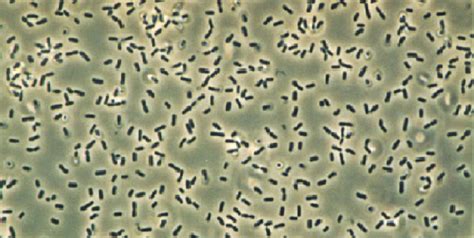 Bacillus Subtilis - The Definitive Guide | Biology Dictionary