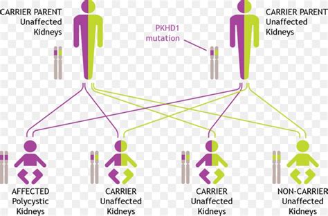 Autosomal Recessive Polycystic Kidney Disease Genetic Testing Autosomal ...