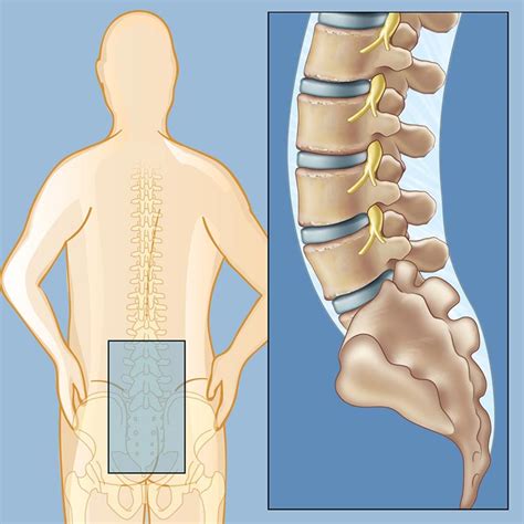 Lower Back Pain | Brain & Spine Center