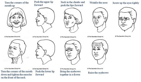 Bells palsy, Bell's palsy exercises, Facial nerve