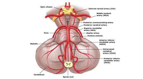 Posterior Circulation Stroke – Core EM