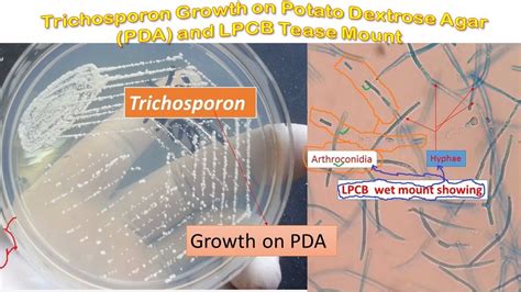 Trichosporon colony morphology on PDA and LPCB Mount Microscopy - YouTube