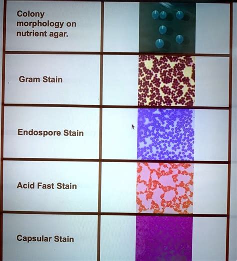 colony morphology on nutrient agar gram stain endospore stain acid fast ...