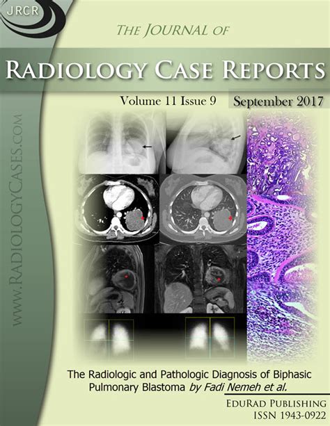 Journal of Radiology Case Reports | Free journal access | Radiology Journal