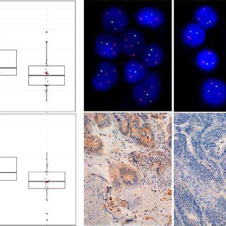 Copy number alterations (CNAs) and EGFR gene expression levels detected ...