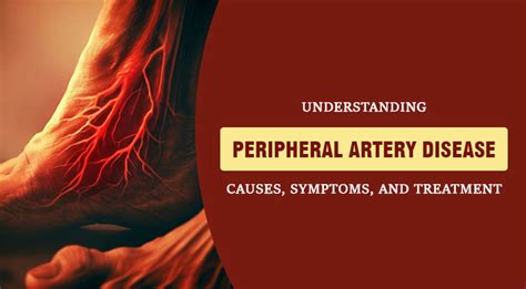 Understanding Peripheral Artery Disease : Causes, Symptoms & Treatment