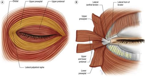 Lateral canthal suspension techniques | Plastic Surgery Key