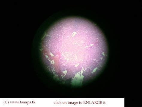 Histology Slides Database: human liver histology slide