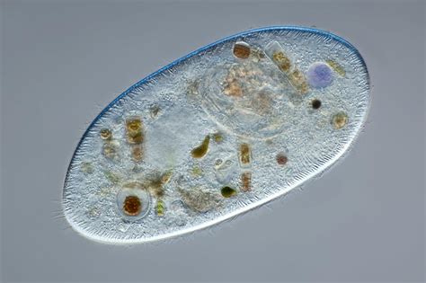 Ciliate protozoan, light micrograph Photograph by Science Photo Library ...