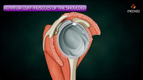 Rotator Cuff Shoulder Muscles Diagram - Va Disability Rating For ...