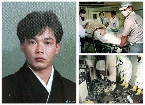 Hisashi Ouchi: The Tragic Story Of A Nuclear Accident Victim