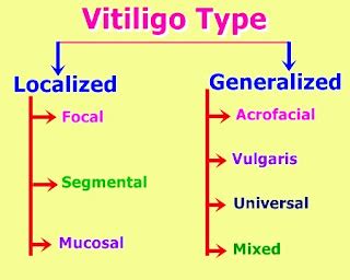 Vitiligo Types: How Many Types of Leucoderma Vitiligo? | Modern Herbalife