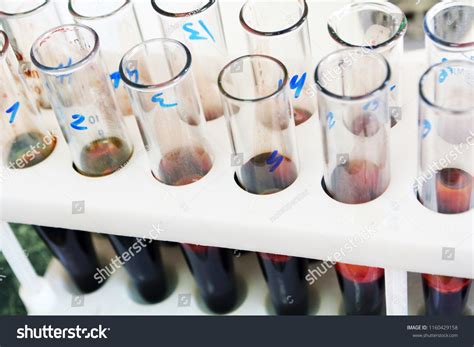 Rack Blood Tubes Barcode Labels Proper Stock Photo 1160429158 ...