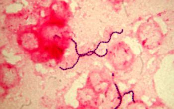 Streptococcus intermedius